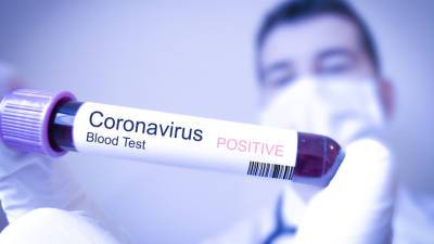 Еще у 18 человек, связанных с Олимпиадой в Токио, выявили коронавирус