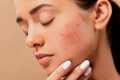 Медики назвали три продукта, которых следует избегать для чистой кожи