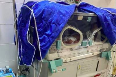 В Ужгороде врачи провели уникальную операции и спасли жизнь недоношенных тройняшек