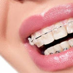 Высококвалифицированный ортодонт в Люмидент - быстрая диагностика, качественное решение проблем с зубами