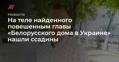 На теле найденного повешенным главы «Белорусского дома в Украине» нашли ссадины