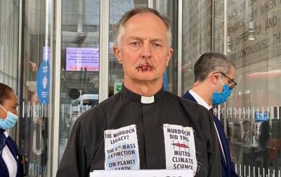 В Великобритании священник зашил себе рот, протестуя против замалчивания проблем изменения климата и мира