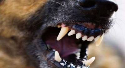Перегрыз артерию: в Запорожье собака до смерти покусала женщину