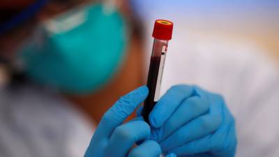 Власти Китая объявили о массовом тестировании на коронавирус в Ухане