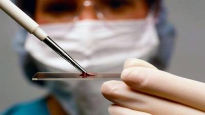Месячник проверки на вирусный гепатит объявлен в Украине – как провериться - lenta.ua - Украина