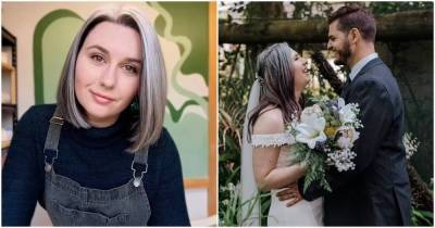 Девушка, поседевшая к 25 годам, перестала красить волосы за год до свадьбы