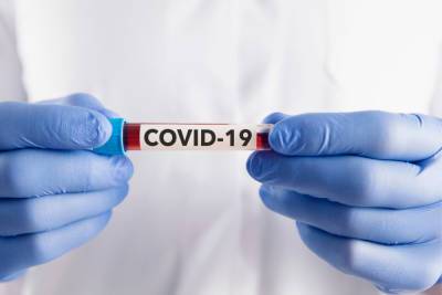В Новгородской области COVID-19 диагностировали еще у 125 человек