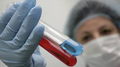 Учёные предупредили о возможной активности гриппа в России