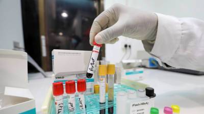 В Молдавии за сутки выявили 216 случаев коронавируса