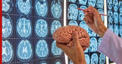 Как сохранить здоровье мозга с возрастом: одну простую привычку назвали ученые