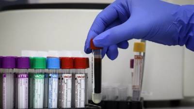 За сутки выявлено 74 новых случаев инфицирования коронавирусом
