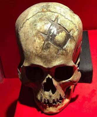 Череп Инка с золотой пластиной-имплантом возрастом более 500 лет найденный в Перу Боксер среднего веса UFC…