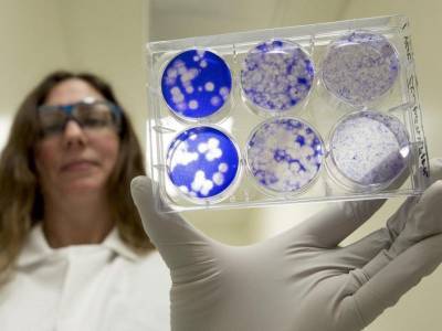 Ученые нашли причину смертельного последствия коронавирусом