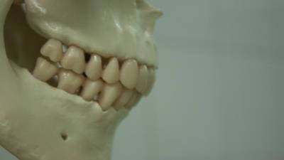 Недолеченные зубы провоцируют спазмы мышц и мигрени