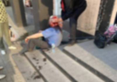 Мужчина, которого засняли в крови в центре Рязани, разбил голову при падении