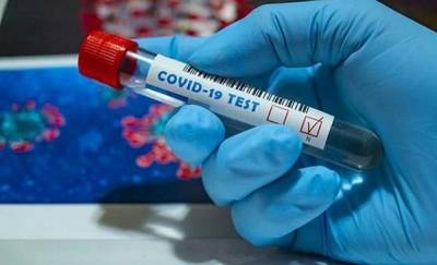 В Тюменской области выявили еще 77 случаев заражения коронавирусом