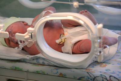 Родившуюся с весом в 212 граммов девочку выписали из больницы