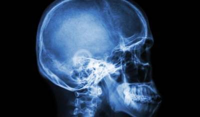В Чехии ПЦР-тест привел к «утечке» спинномозговой жидкости через нос пациента