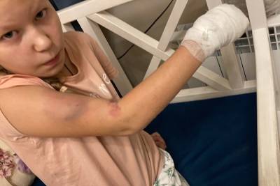 В Ярославле водитель автобуса травмировал школьницу