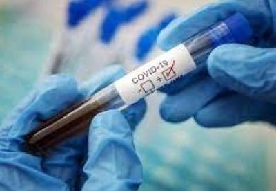 В Украине за сутки 2477 новых случая коронавируса