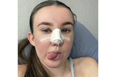 Затравленная из-за формы носа школьница потратила 800 тысяч рублей на пластику