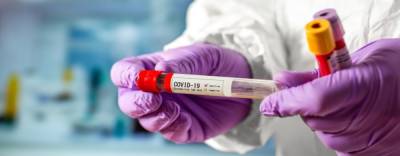 Еще 13 новосибирцев с коронавирусом умерли от осложнений за минувший день
