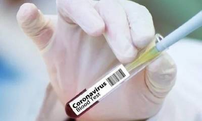 Зараженных коронавирусом выявили в 16 муниципалитетах Смоленской области