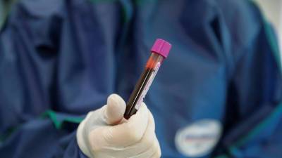 В Нижегородской области зарегистрировали 419 случаев коронавируса за сутки