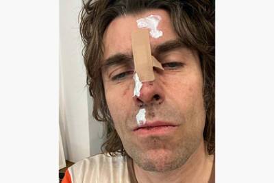Экс-вокалист британской рок-группы Oasis выпал из вертолета, но жив