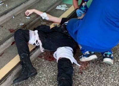 Пермскому стрелку Тимуру Бекмансурову в больнице ампутировали левую ногу