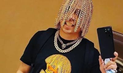 Мексиканский рэпер вживил себе в голову золотые цепи вместо волос