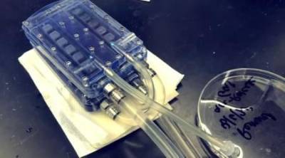 Создан прототип первой биоискусственной почки для трансплантации вместо диализа