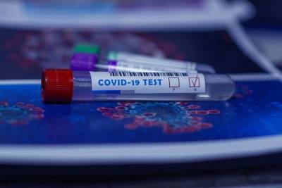 Медики ЛНР озвучили количество заболевших COVID-19 за сутки