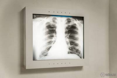 Российский рентгенолог рассказал о лучшем способе диагностики пневмонии при COVID-19
