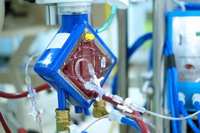 В израильских больницах не хватает персонала для аппаратов ЭКМО