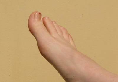 Специалисты Mayo Clinic заявили, что замедление роста ногтей на ногах может указывать на опасный уровень холестерина