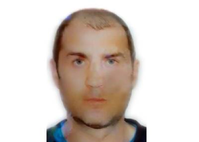 Мужчина со шрамами на лице пропал из больницы в Смоленске