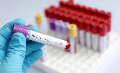 Жители Заводоуковска могут бесплатно и анонимно пройти ВИЧ-тестирование