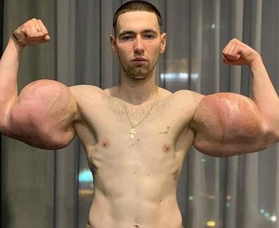 Современный Попай: парень нарастил себе мышцы с помощью вазелина