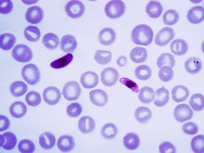 Возбудитель малярии научился скрываться от диагностических тестов