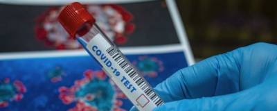 Правительство профинансирует создание лабораторий ускоренной диагностики ковида в России