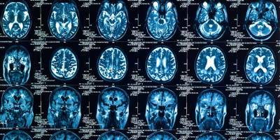 Даже легкие случаи «короны» повреждают головной мозг