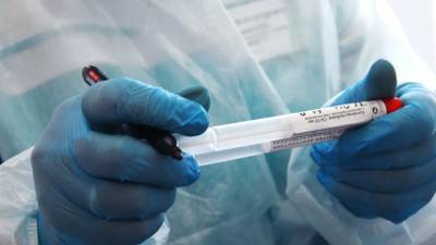 Российские медработники сообщили, что первые симптомы COVID-19 можно спутать с гриппом