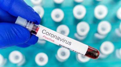 Вирусологи ждут, что коронавирус со временем станет менее опасным для человека