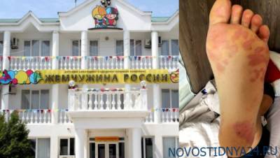 Вирус Коксаки, тучи комаров, отвратная еда: как отдыхают дети в «Жемчужине России»