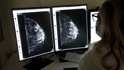 Российские ученые создают методику «выключения» метастазирования при раке груди