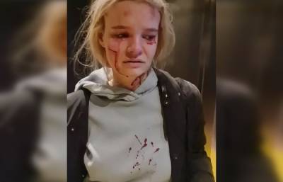 Жительница Подмосковья пострадала из-за неисправного пассажирского лифта