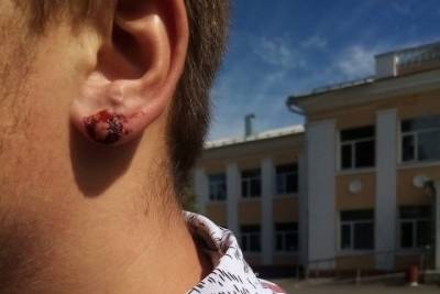 Директор школы в Курской области порвал ухо ученику за отказ снять серьгу