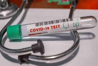 Почти 540 тысяч тестов на COVID-19 провели медики в Смоленской области