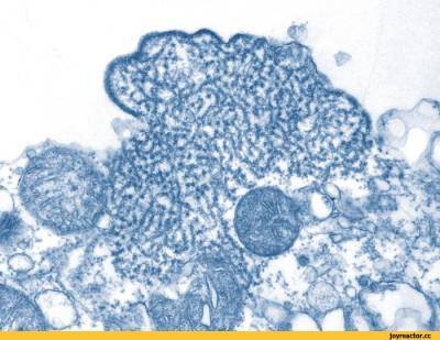 Новая эпидемия — В индийском штате Керала у 11 человек выявлены симптомы заражения вирусом Нипах